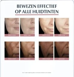 Eucerin Anti-Pigment Spotcorrector - Concealer - 5 Ml -Glam Make-up Verkoop 1157x1200 3