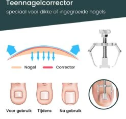 7-Delige Pedicure Set - Nagelverzorging - Nagelset Starterset - Ingegroeide Teennagel - Kalknagelproducten - Pedicuresets - RVS -Glam Make-up Verkoop 1200x1130 18