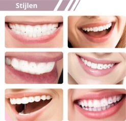 Tooth Gem Kit- TandKristal - DIY- Tandkristallen Set -Tooth Crystal 14 Tooth Gem Kit- TandKristal - DIY- Tandkristallen Set -Tooth Crystal -Glam Make-up Verkoop 1200x1158 1