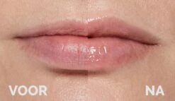 Instant Effects - 3D Lip Plumper Lipgloss Lip Filler - 20% Vollere Lippen In Slechts 2 Minuten! 7 Instant Effects - 3D Lip Plumper Lipgloss Lip Filler - 20% Vollere Lippen In Slechts 2 Minuten! -Glam Make-up Verkoop 1200x696 1