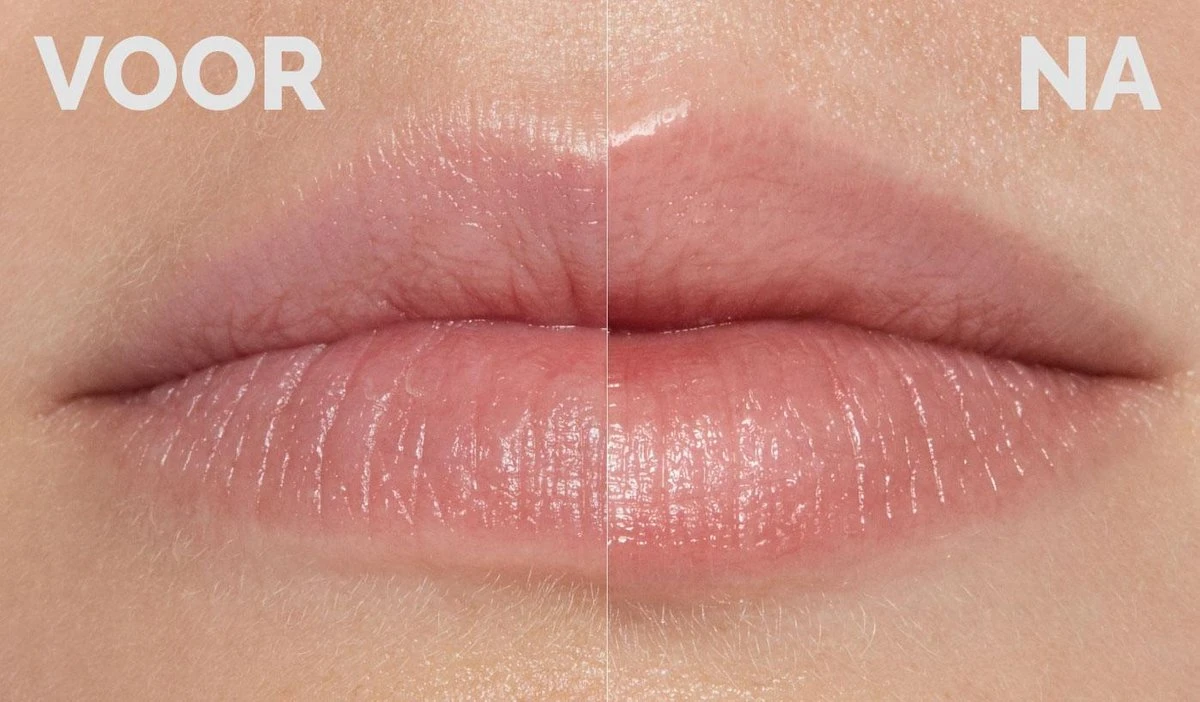Instant Effects - 3D Lip Plumper Lipgloss Lip Filler - 20% Vollere Lippen In Slechts 2 Minuten! 2 Instant Effects - 3D Lip Plumper Lipgloss Lip Filler - 20% Vollere Lippen In Slechts 2 Minuten! - Afbeelding 2