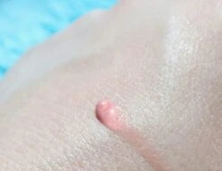 Biodermal Sun Lipbalm SPF25 - Tube 12 Ml - Natural Pink - Lippenbalsem -Glam Make-up Verkoop 1200x927 7